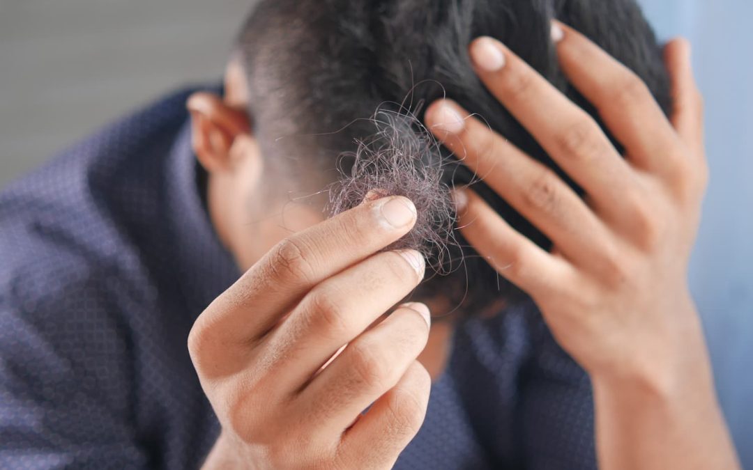 Alopecia androgenética, causas y tratamientos eficaces